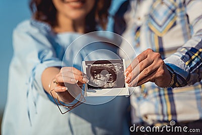 Pregnant couple holding ultrasound scan. Concept of Pregnancy health care Stock Photo