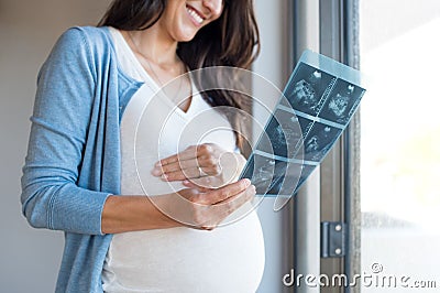 Pregnant woman holding ultrasound Stock Photo