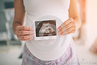 Pregnant woman holding ultrasound scan. Concept of Pregnancy health care Stock Photo