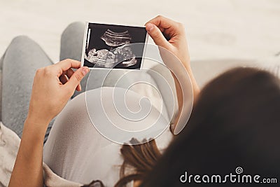 Pregnant woman looking at her baby sonography Stock Photo