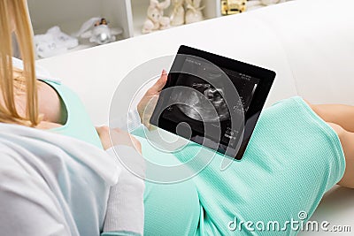 Pregnant woman looking at ultrasonography of her baby Stock Photo