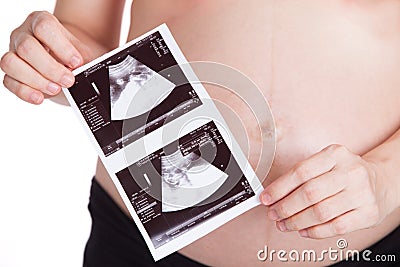 Pregnant woman show image ultrasound on white background Stock Photo