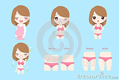 Pregnant woman with stretch marks Vector Illustration