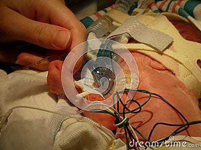 Premature baby with CPAP mask holding finger Stock Photo