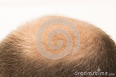 Premature baldness, man, 40s, white background Stock Photo