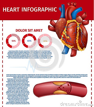 Infographic Realistic Heart and Blocked Fat Vessel Vector Illustration