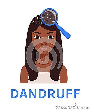 Pretty Afro Black Girl and Dandruff on her Head for medical design. Hair scalp problem. Close-up view of dandruff Magnifying Glass Vector Illustration