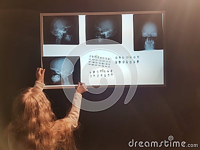 Pretty girl uses a negatoscope to view important information. Stock Photo