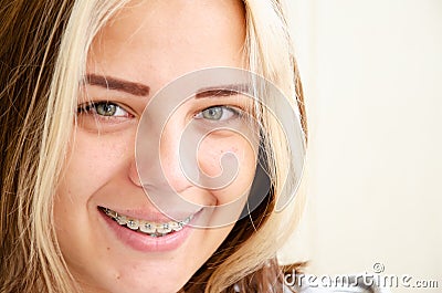 Pretty teen girl in dental braces. Brunette caucasian young girl with green eyes looks at camera and smiles. Teenage concept. Stock Photo