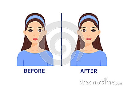 Pretty Woman with a Big Nose. Correction and Plastic Surgery. Before After. Beautiful Little nose and Happy Lady. Smile on Face. Vector Illustration