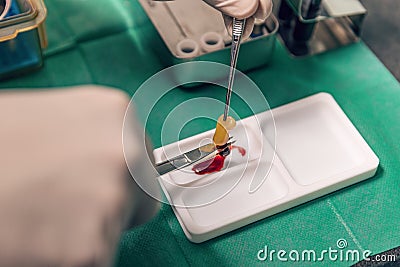 PRF platelet rich fibrin therapy Stock Photo