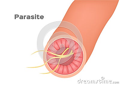 Parasite in stomach and intestine vector Vector Illustration