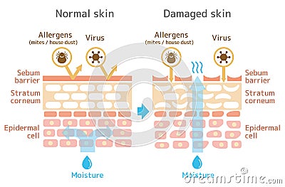 Sectional view of the skin illustration. Comparison of protection effect between healthy skin and wounded skin Vector Illustration