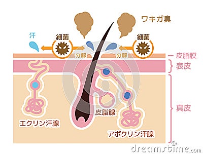 Cause of body odor vector illustration / japanese Vector Illustration