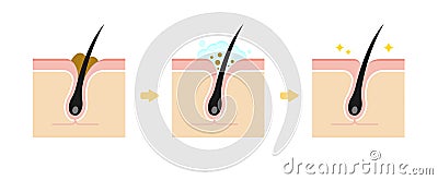 Structure illustration of pores cleansing Vector Illustration