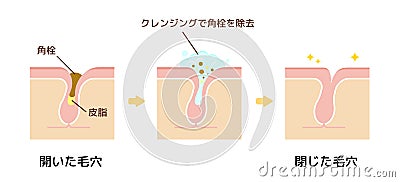 Structure illustration of pores cleansing / Japanese Vector Illustration