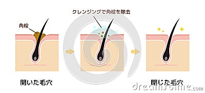 Structure illustration of pores cleansing / Japanese Vector Illustration