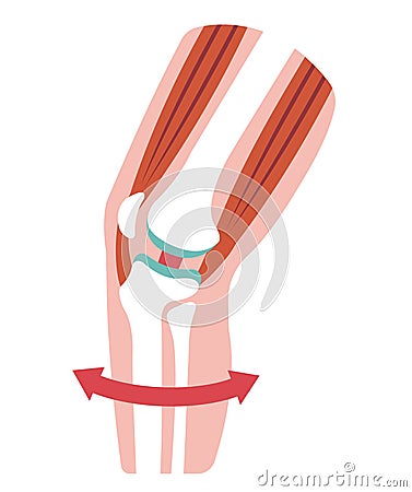 Mechanism and causes of knee joint pain / no text Vector Illustration