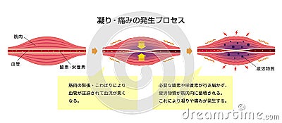 Process of muscle`s stiffness and pain / Japanese Vector Illustration
