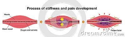 Process of muscle`s stiffness and pain / English Vector Illustration