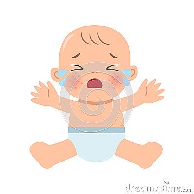 Baby having eczema skin problem on face Vector Illustration