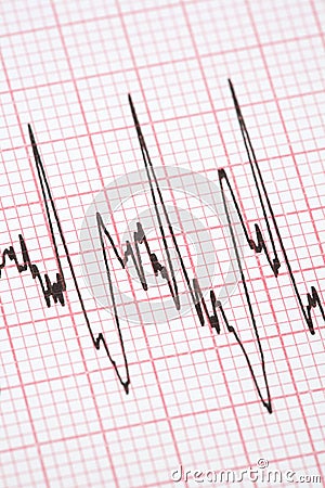 Printout from cardiograph Stock Photo