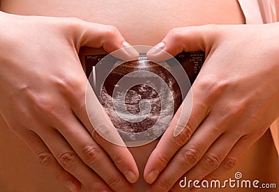 Printout of fetus Stock Photo