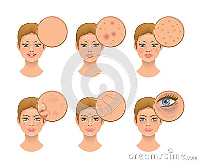 Problem skin Vector Illustration