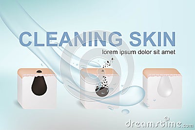 Procedure clean clogged pores on facial. Illustration about beauty and skin care. Vector Illustration