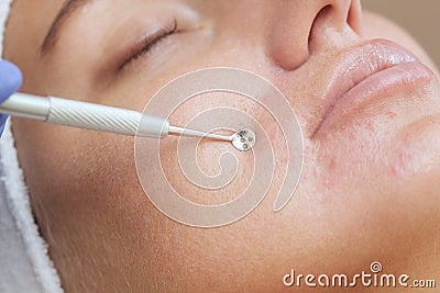 Procedure for cleaning the skin of the face with a steel appliance with a spoon from blackheads, acne. Stock Photo