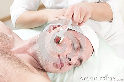 procedure of medical micro needle therapy with a modern medical instrument derma roller. Stock Photo