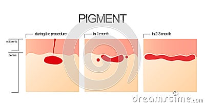 The process of engraftment of the pigment after the salon procedure of permanent make-up. Stock Photo