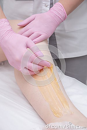 The process of sugar depilation. Master in medical gloves puts a yellow paste on the client`s leg Stock Photo