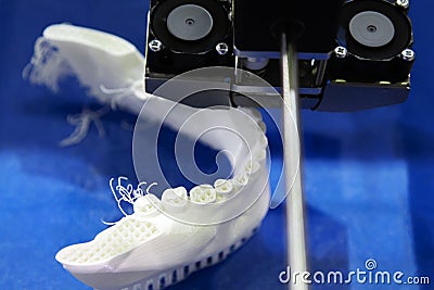 Production of dental prostheses. Printing on a 3D printer Stock Photo