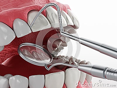 Professional dentist tools isolated on white background. 3D illustration Cartoon Illustration