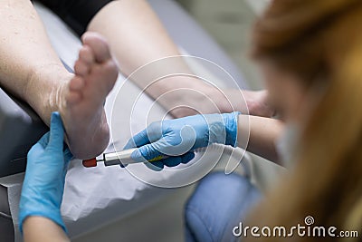 Professional removal of dead skin from hardened heels in a beauty salon. Stock Photo