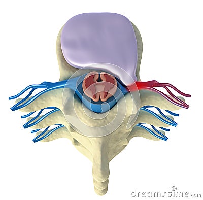 Prolapse of intervertebral disc Stock Photo