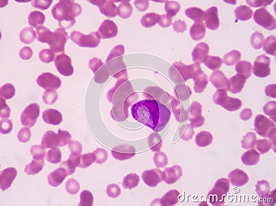 Promyelocyte. Stock Photo