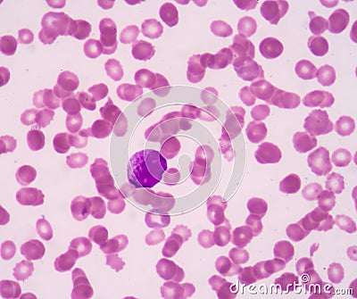 Promyelocyte. Stock Photo