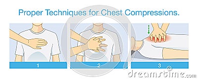 Proper Techniques for Chest Compression. Vector Illustration