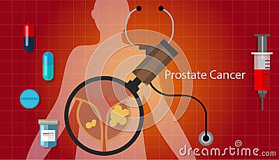 Prostate cancer health medical illustration medication cure Vector Illustration