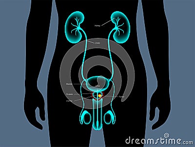 Prostate cancer concept Vector Illustration