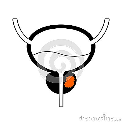 Prostate cancer concept Vector Illustration