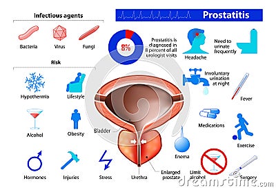 Prostatitis. benign enlargement of the prostate Vector Illustration