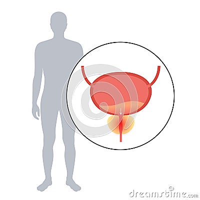 Prostatitis inflammation problem Vector Illustration