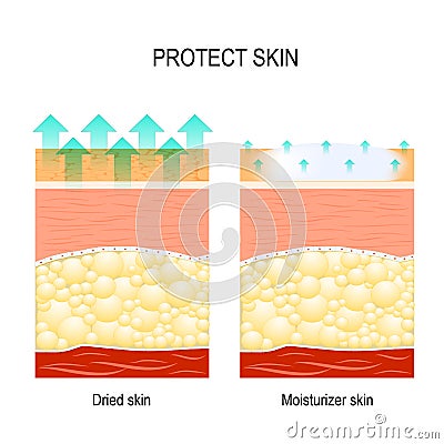 Protect sensitive skin Stock Photo