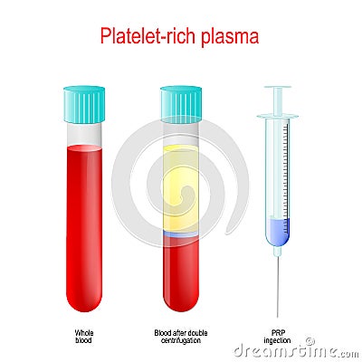 PRP. Two test tubes and syringe with blood and platelet-rich plasma Vector Illustration