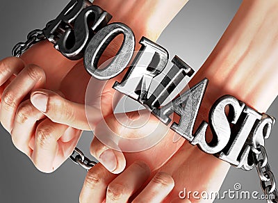 Psoriasis, social impact and its influence - a concept showing a person`s hands in chains with a word Psoriasis as a symbol of it Cartoon Illustration
