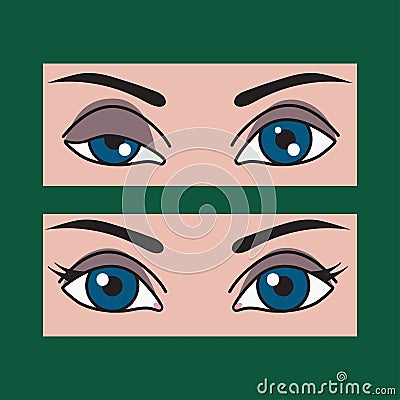 Ptosis, asymmetry of eyes Vector Illustration