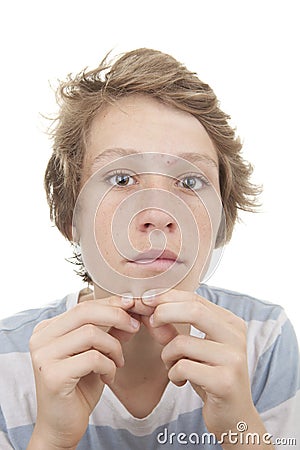 Puberty acne spots Stock Photo